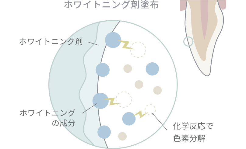 歯を白くするメカニズム